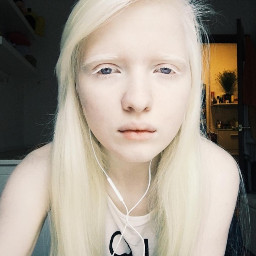 albino pale girl woman headset
